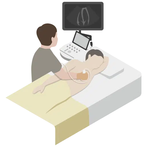 ecocardiografie,ecocardiografie Bucuresti ecocardiografie-transtoracica