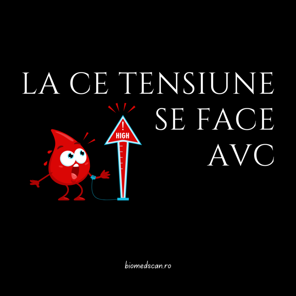 la ce tensiune se face avc